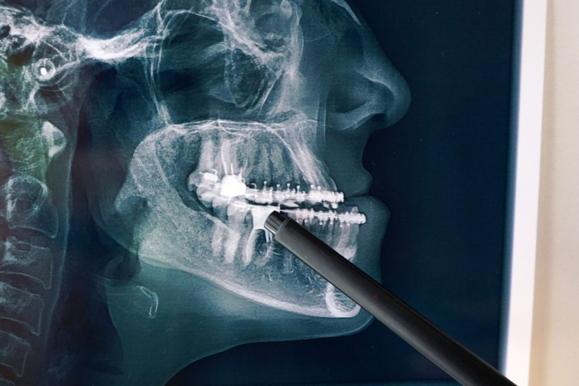 Cirurgião dentista bucomaxilofacial